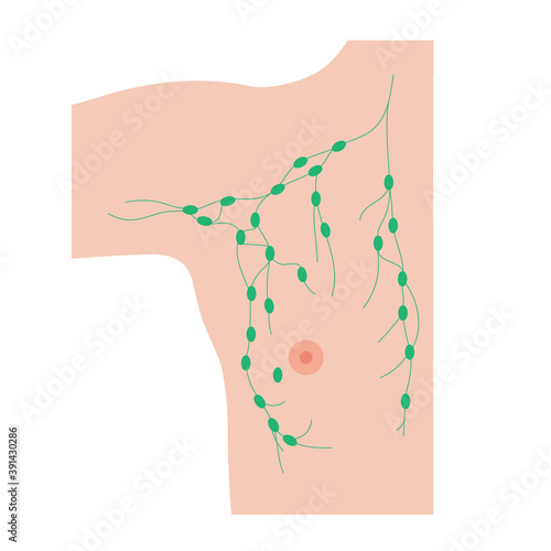 Breast disease concept