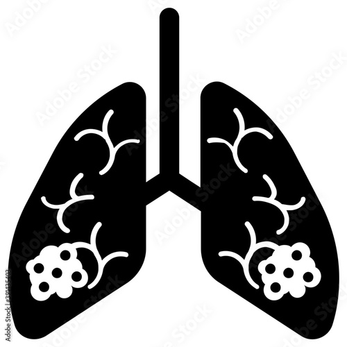 Lung Cancer 
