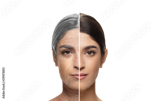 Comparison. Portrait of beautiful jewish woman with problem and clean skin, aging and youth concept, beauty treatment and lifting. Before and after. Youth, old age. Process of aging and rejuvenation