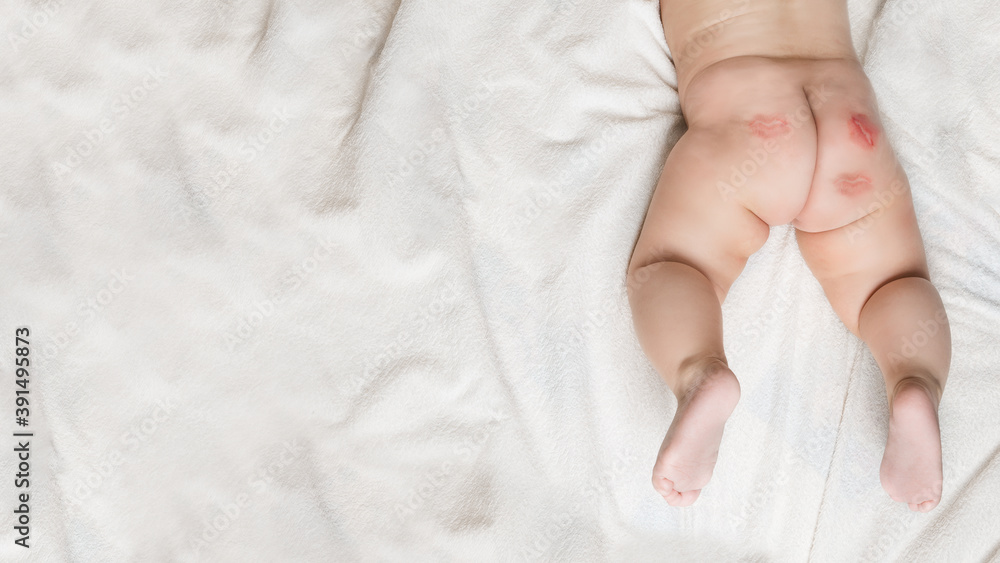 Baby's buttock with a kiss. Child taking air baths. naked baby butt and legs on white bed. Dry and healthy body and skin. no diaper. copy space Baby's buttock with a kiss. Child taking air baths. naked baby butt and legs on white bed. Dry and healthy body and skin. no diaper. copy space