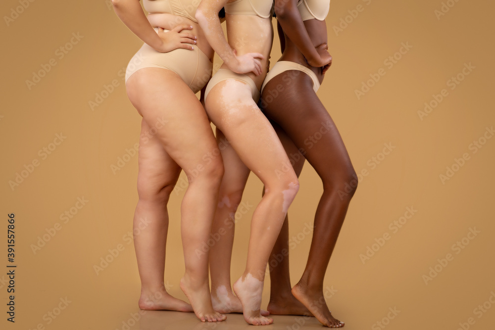 Body positivity. Three ladies with owerweight, vitiligo and stretch marks posing together - obrazy, fototapety, plakaty 