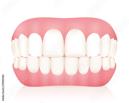 Dentures. False teeth. Isolated vector illustration on white background.
