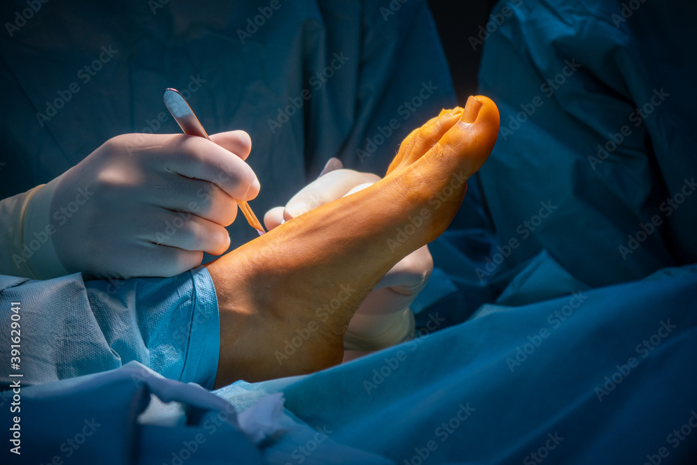 Foot Incision surgeon makes an incision on one foot with a scalpel Stock Photo ...