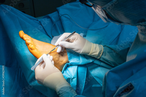 Tableau sur toile a surgeon makes an incision on one foot with a scalpel