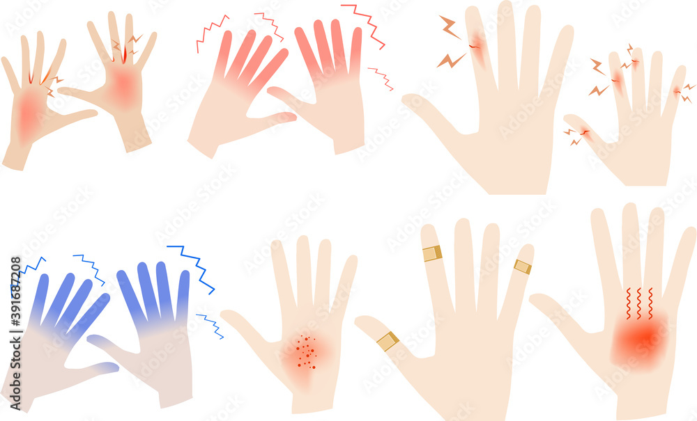 custom made wallpaper toronto digital切り傷・霜焼け・火傷、冷え性、手荒れの手のイラストセット