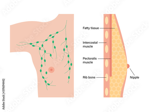 Breast disease concept