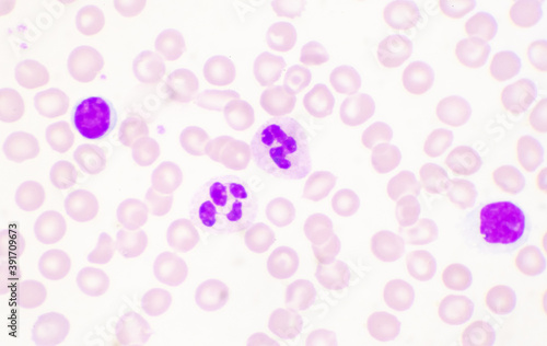 Mature lymphocyte on red blood cells background.