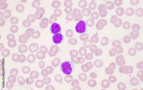 Mature lymphocyte on red blood cells background. photo