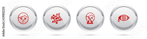 Set line Face with psoriasis or eczema, Medicine pill tablet, Handkerchief to his runny nose and Reddish eye allergic conjunctivitis. Silver circle button. Vector.