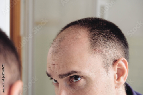 Young man looking at mirror worry about balding. photo