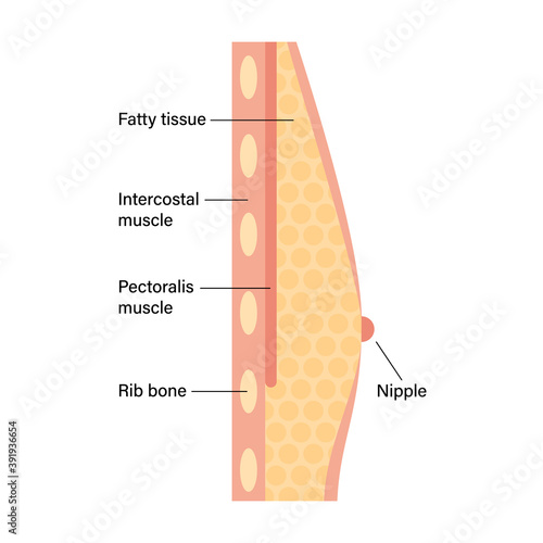Breast disease concept