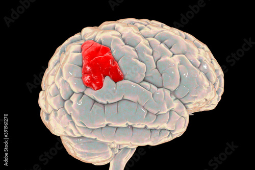 Human brain with highlighted supramarginal gyrus photo