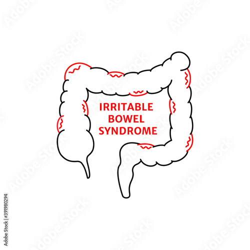 linear irritable bowel syndrome sign