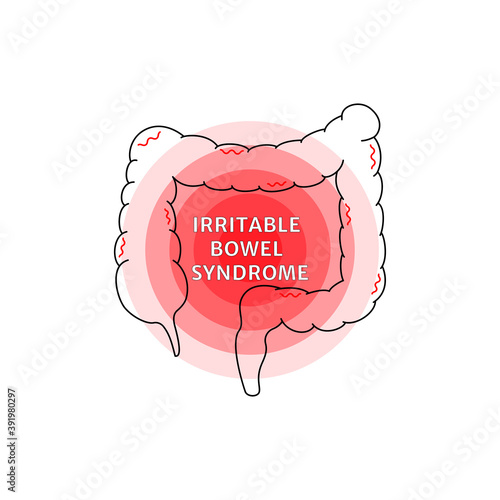 irritable bowel syndrome sign