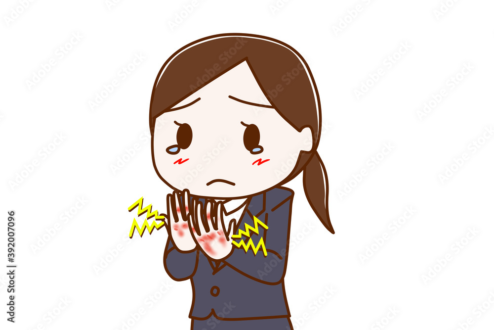 両手の手荒れが酷くてヒリヒリ痛いスーツ姿の女性 両手の手荒れが酷くてヒリヒリ痛いスーツ姿の女性
