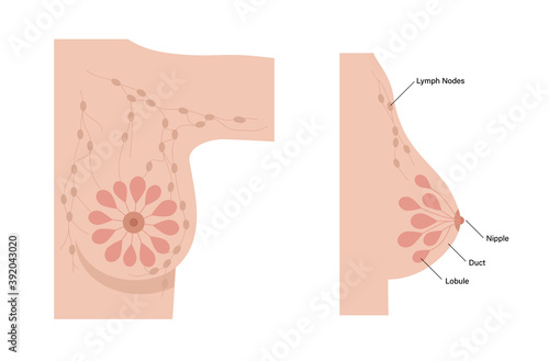 Breast disease concept
