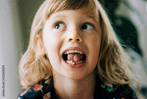 young girl with wobbly tooth pulling faces showing her tooth photo