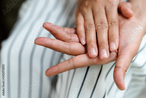 brittle damaged nails after using shellac or gel-lacquer photo