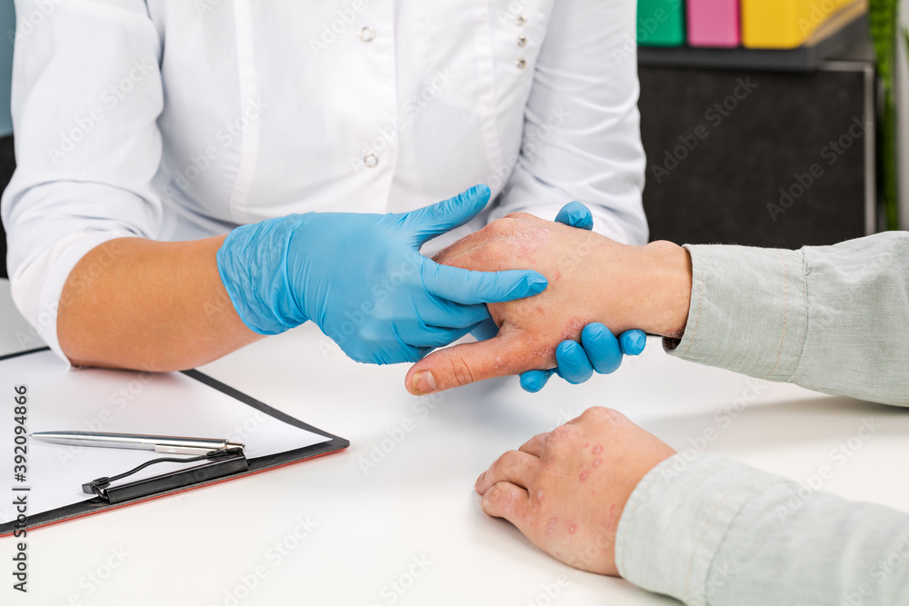 A dermatologist wearing gloves examines the skin of a sick patient. Examination and diagnosis of skin diseases-allergies, psoriasis, eczema, dermatitis A dermatologist wearing gloves examines the skin of a sick patient. Examination and diagnosis of skin diseases-allergies, psoriasis, eczema, dermatitis