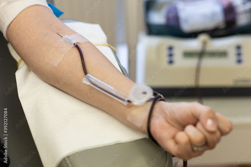 in hand of woman a needle in vein and blood transfusion system. soft focus