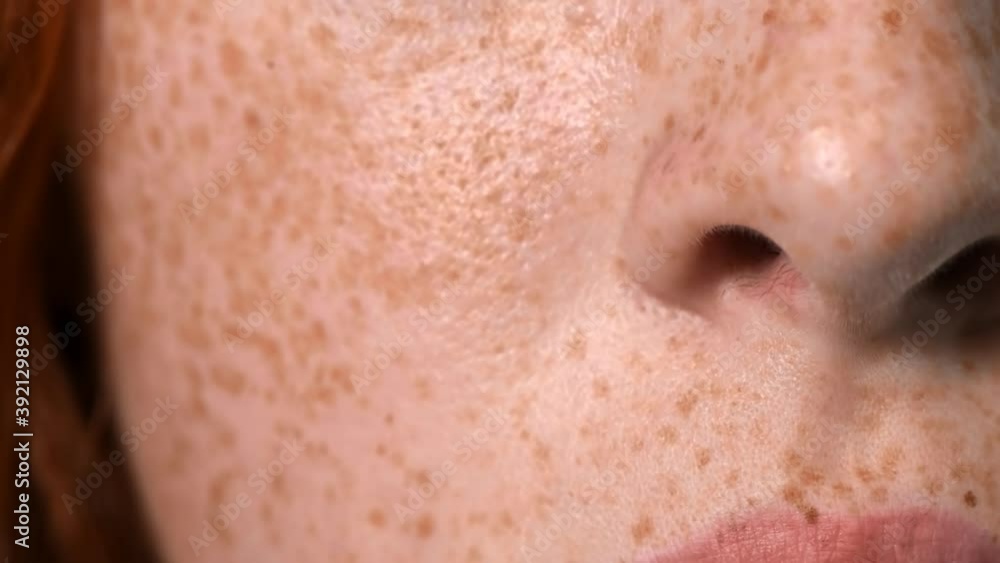 Red haired girl with lots of freckles on the face and blue eyes looking into the camera. White background. Close up Red haired girl with lots of freckles on the face and blue eyes looking into the camera. White background. Close up
