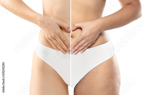 Overweight woman with cellulite legs and belly in white underwear comparing with fit and thin body isolated on white background. Orange peel skin, liposuction, healthcare, beauty, sport, surgery.