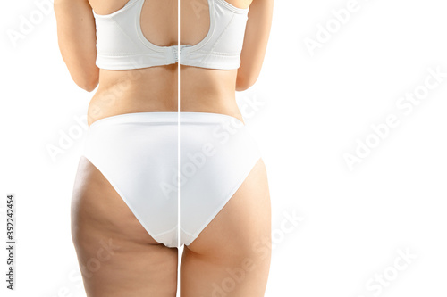 Overweight woman with cellulite legs and buttocks in white underwear comparing with fit and thin body isolated on white background. Orange peel skin, liposuction, healthcare, beauty, sport, surgery.
