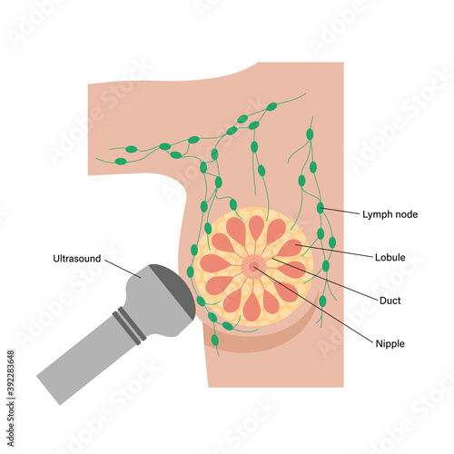 Breast disease concept