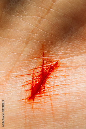 Fresh bloody cut on human hand