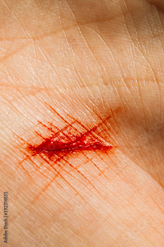 Fresh bloody cut on human hand