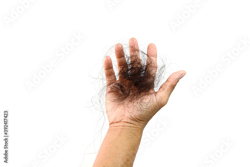 Hand hair loss, hair loss, serious problem of daily life, hair loss on white background.