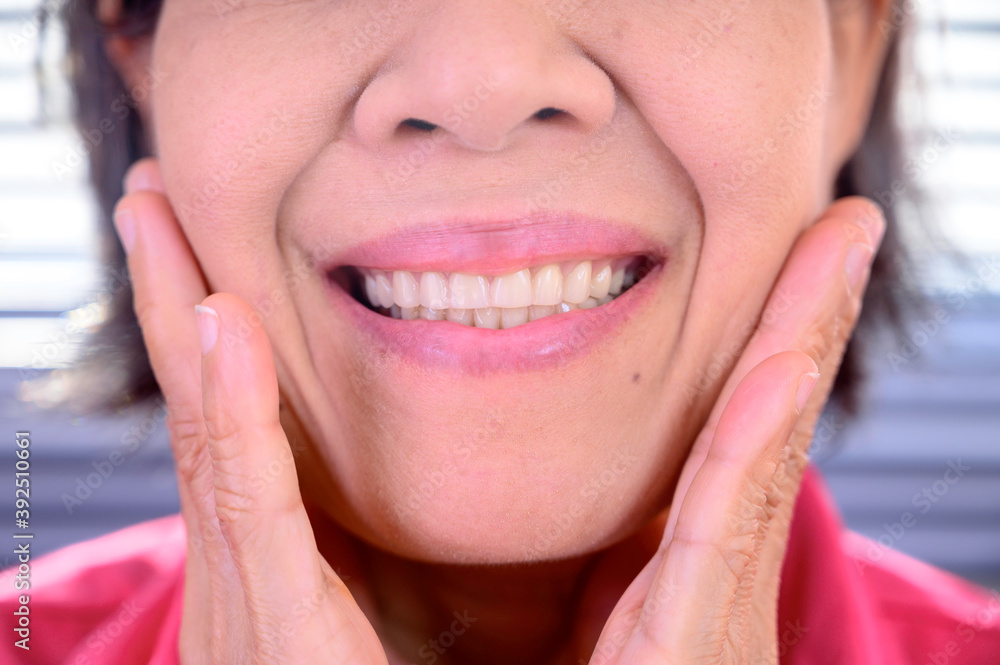 An elderly Asian smile with her new dentures. An elderly Asian smile with her new dentures.
