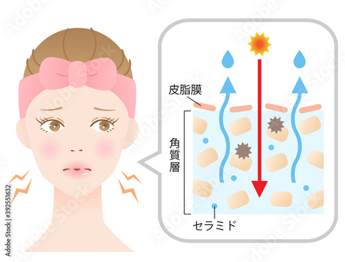 乾燥肌　断面図　女性