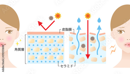 乾燥肌　断面図　女性　ビフォアアフター