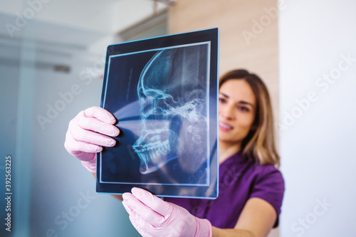 Teeth radiography being holded by a mexican woman dentist © Marcos