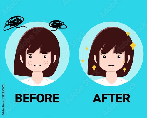 Acne in women. Before and after. Illustration vector