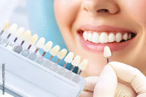 Smiling young woman. Cosmetological teeth whitening in a dental clinic. selection of the tone of the implant tooth photo
