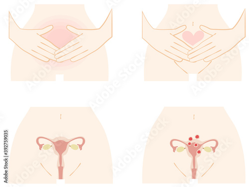 女性の下腹部と子宮のセット