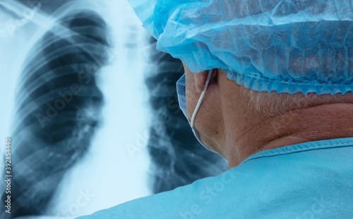 Doctor examines an X-ray of a lung