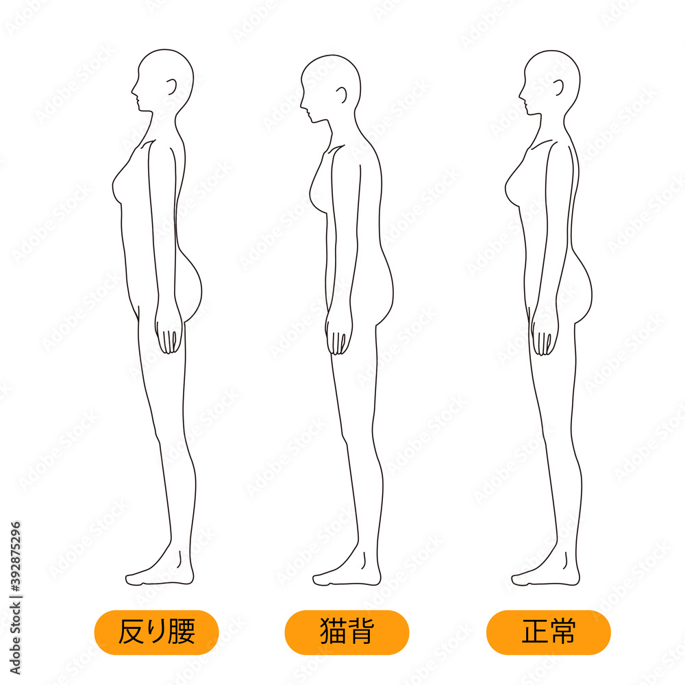 女性 メディカル 姿勢 反り腰 猫背 美容 裸 ヌード 全身 横 Stock ベクター Adobe Stock 女性 メディカル 姿勢 反り腰 猫背 美容 裸 ヌード 全身 横 Stock ベクター Adobe Stock