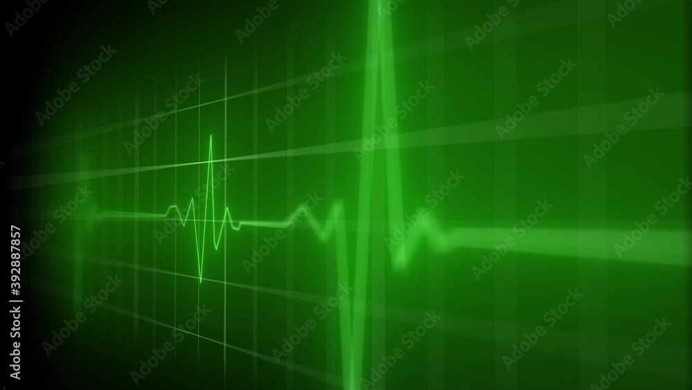 Slowmotion concept animation of an ECG , EKG heartbeat cardiogram on a green monitor in 4k Slowmotion concept animation of an ECG , EKG heartbeat cardiogram on a green monitor in 4k