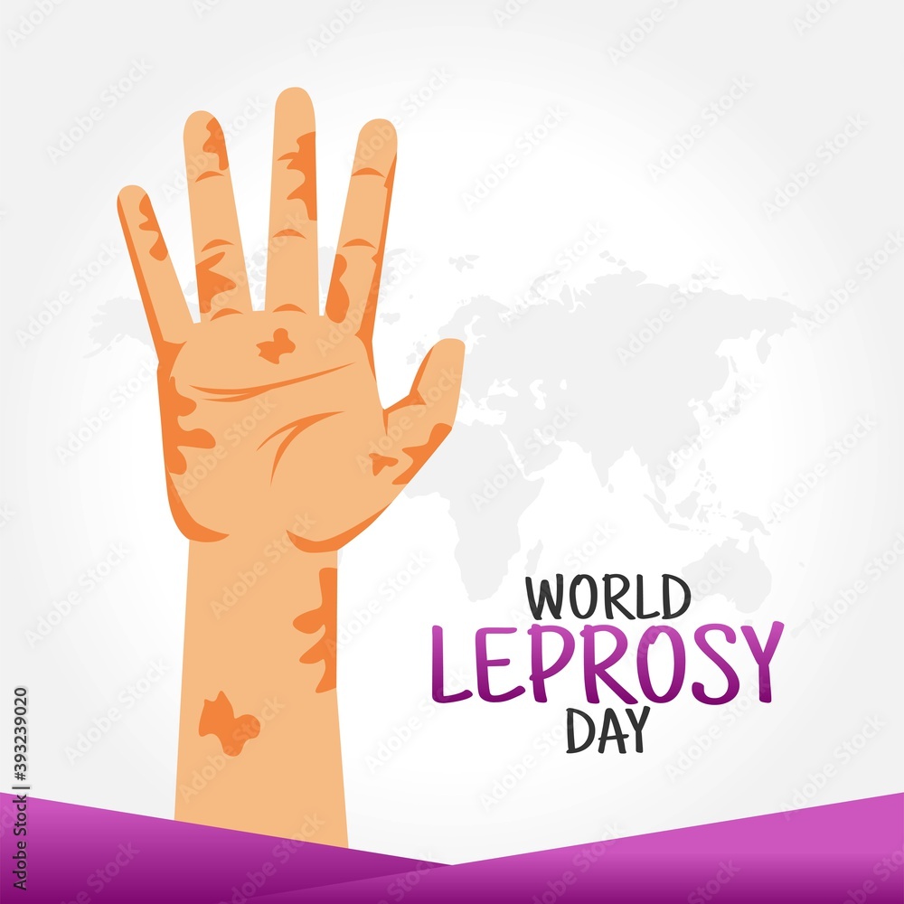 Fototapeta premium World Leprosy Day Vector Illustration. Suitable for greeting card poster and banner