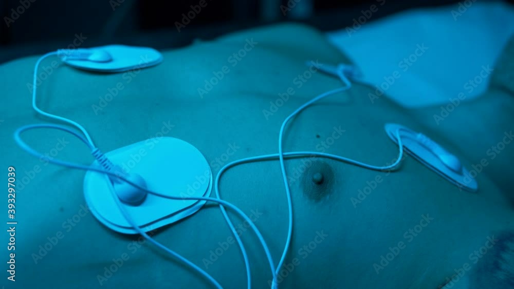 The chest of a man lying on an operating table, connected to the equipment with special wires. Scientific or medical laboratory concept. The chest of a man lying on an operating table, connected to the equipment with special wires. Scientific or medical laboratory concept.