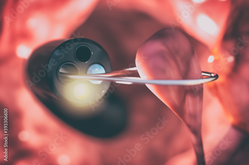Colonoscopy and gastroscopy device