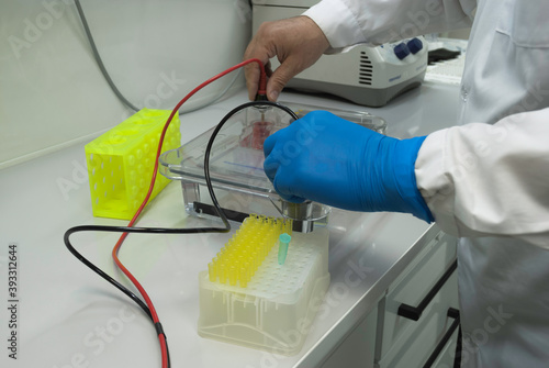 electrophoresis run
