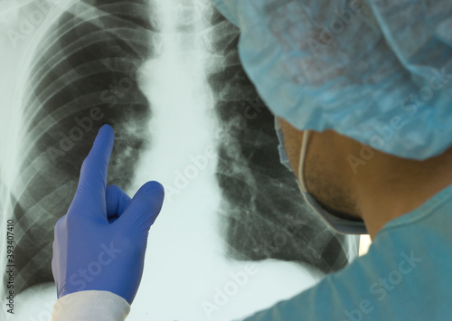 A doctor examines an X-ray of a patient s lung infected with covid-19 coronavirus, © andrii