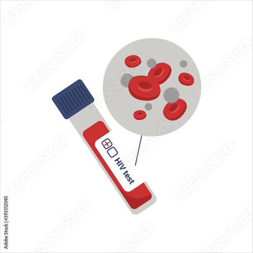 Test tube with blood and cells with infection. Analysis in laboratory. World AIDS Day. Flat vector illustration.