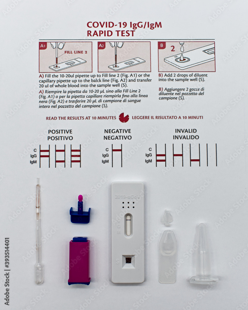 Covid19 IgG/IgM Rapid Kit Test. SARSCoV2 Serological Kit Test
