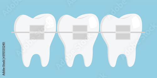 Teeth with braces. Dentistry. Flat design vector illustration