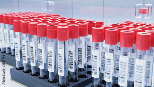 EDTA Blutproben Gefäße mit Barcode in Labor
